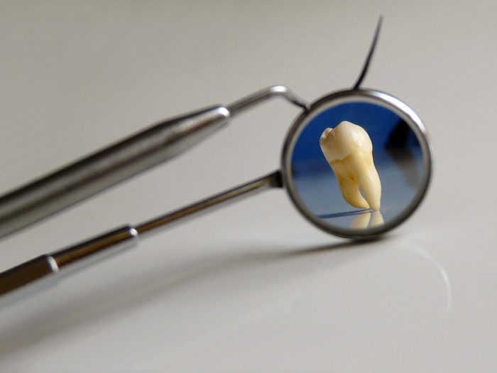 Tandtrolleri. Snusare tenderar oväntat nog, att ha bättre munhälsa än genomsnittet. Karies trivs i sura miljöer och snus ökar pH-värdet i munnen. Foto: Flickr / Partha S. Sahana